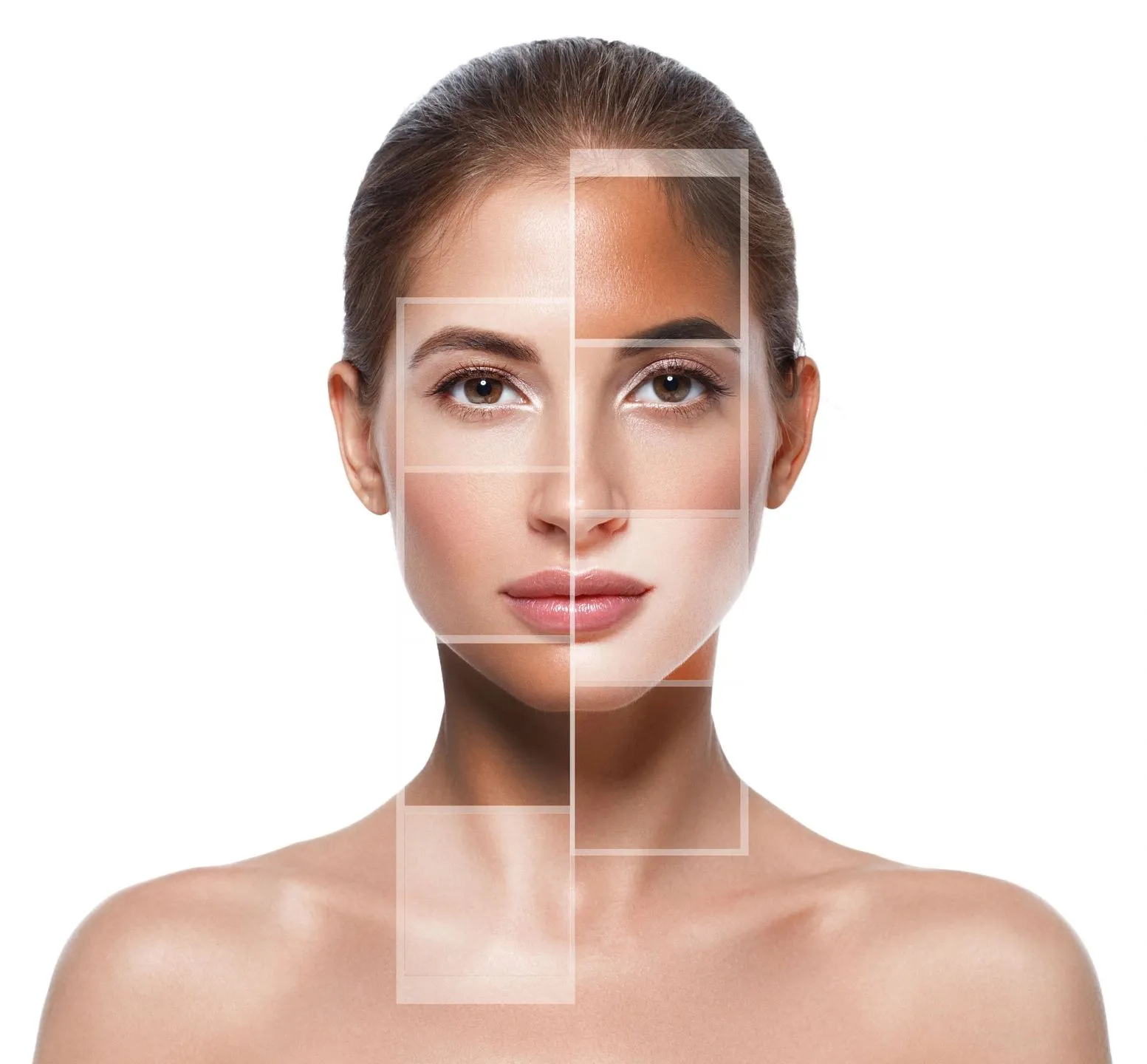 Skin analysis of the face before microdermabrasion at Uneka Facials, Lodi CA